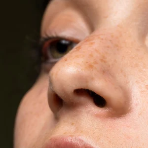 close up woman with freckles